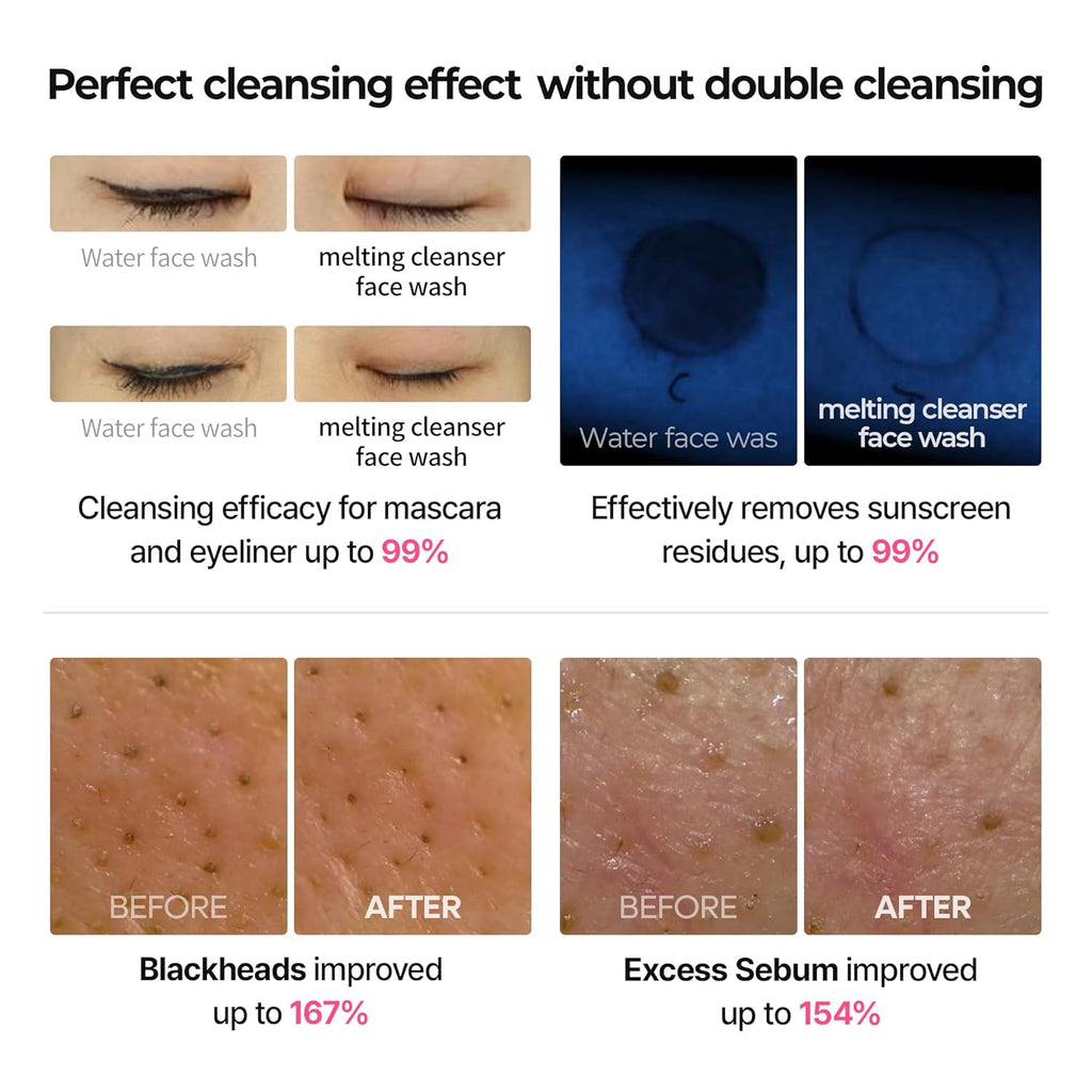 Dr.Melaxin Melting Cleanser - Hypoallergenic Makeup Remover with Quick Bubble, Deep Pore Cleansing for All Skin Type, 150Ml
