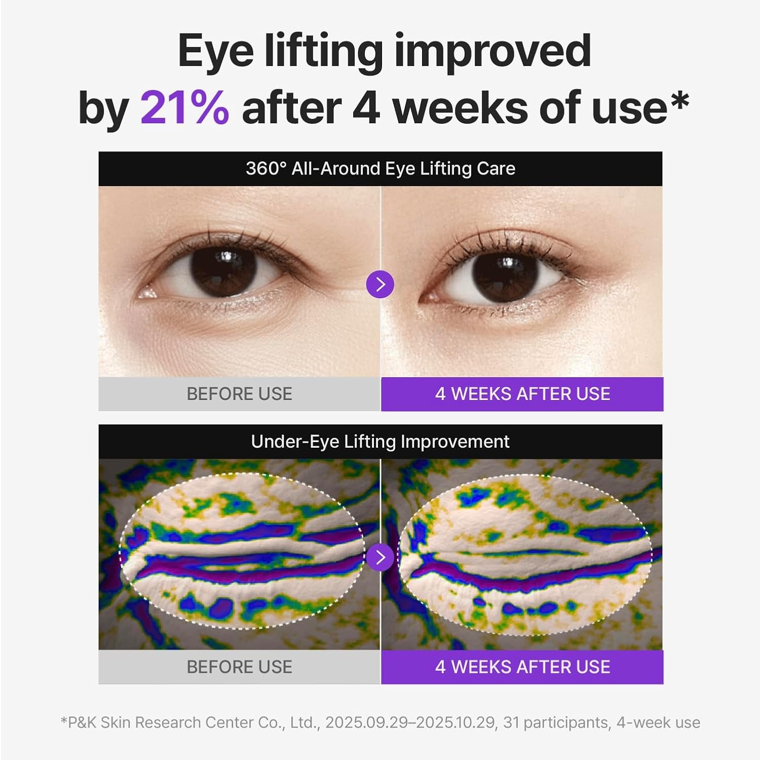 Centellian24 360 Shot PDRN Firming Eye Cream 30Ml (1.01 Fl Oz) – Anti-Aging Retinol Eye Cream for Hooded Eyes, Wrinkle Smoothing, Firming Hydrating Care for Under-Eye Bags, Crow’S Feet & Dark Circles