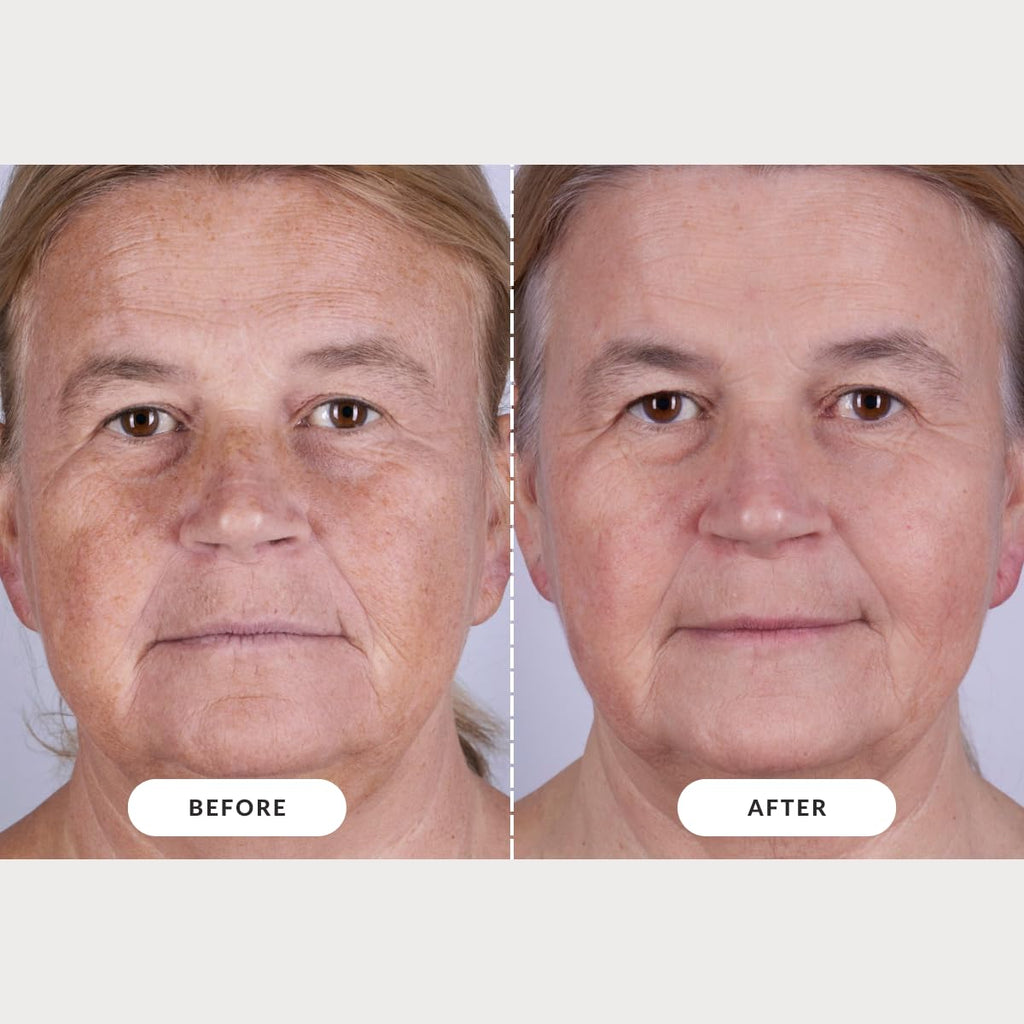 Currentbody Skin LED Light Therapy Mask: Series 2