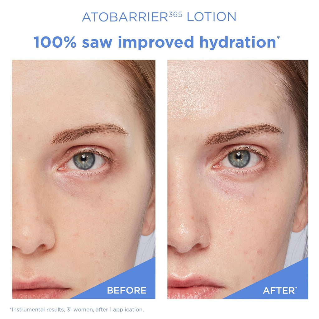 AESTURA ATOBARRIER365 Lightweight Korean Face Moisturizer with Ceramides | Strengthens Barrier, Fast-Absorbing Hydration, Suitable for Dry, Normal & Sensitive Skin, 150ML / 5.07 Fl. Oz.