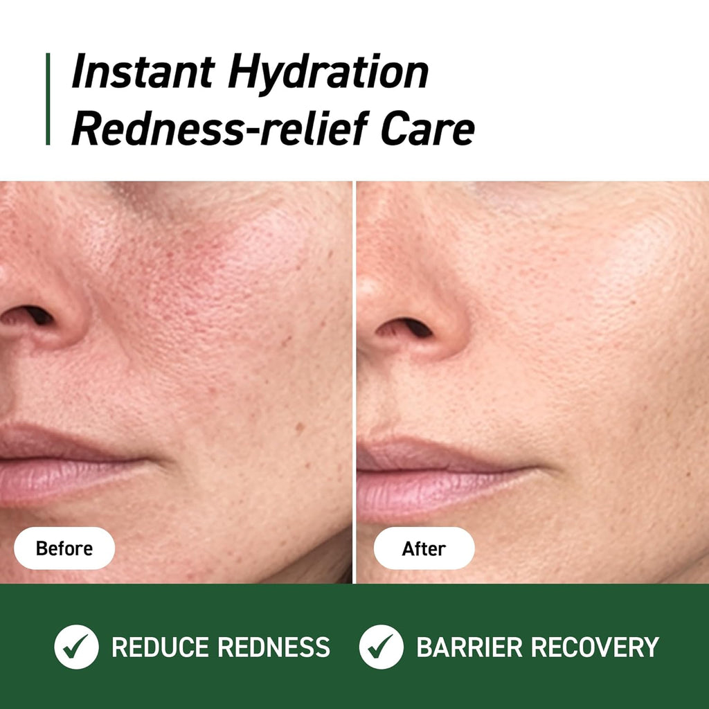 IVOSKIN Cica Redness Relief Treatment Cream, Soothing & Hydrating Green Correcting Moisturizer with Madecassoside, Helps Repair Skin Barrier for Sensitive Skin, Vegan, Korean Skincare (1.76Oz / 50G)