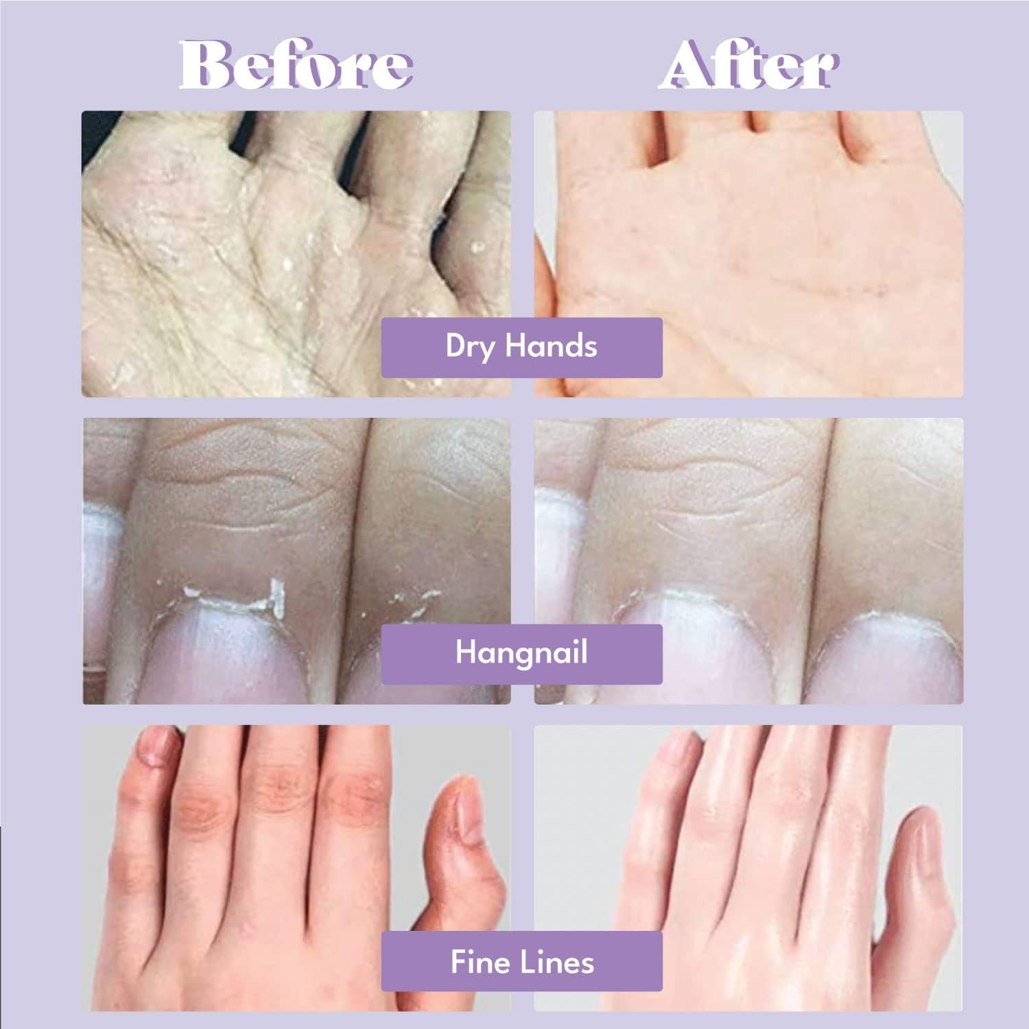 Extra Silky Hand Mask 5 Pairs, Moisturizing Gloves for Dry Hands with White Truffle, Green Caviar & Peptides, Repairing and Softening Hand Care Treatment for Aging, Cracked, and Dry Skin