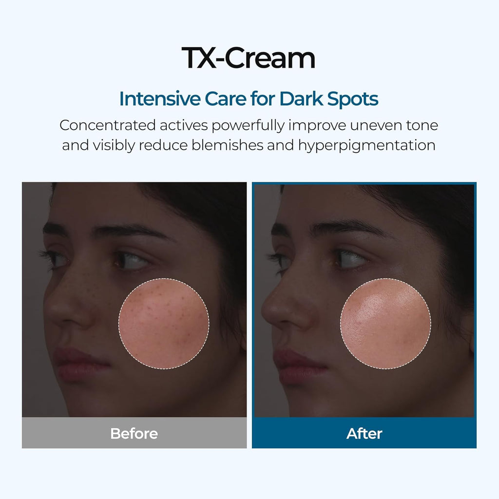 Dr.Melaxin TX Tranexamic Acid CREAM | Skin Freckle Cream, Blemishes, Anti-Pigmetation Korean Skin Care | Korean Cosmetics | 1.7 Fl Oz (50 Ml)