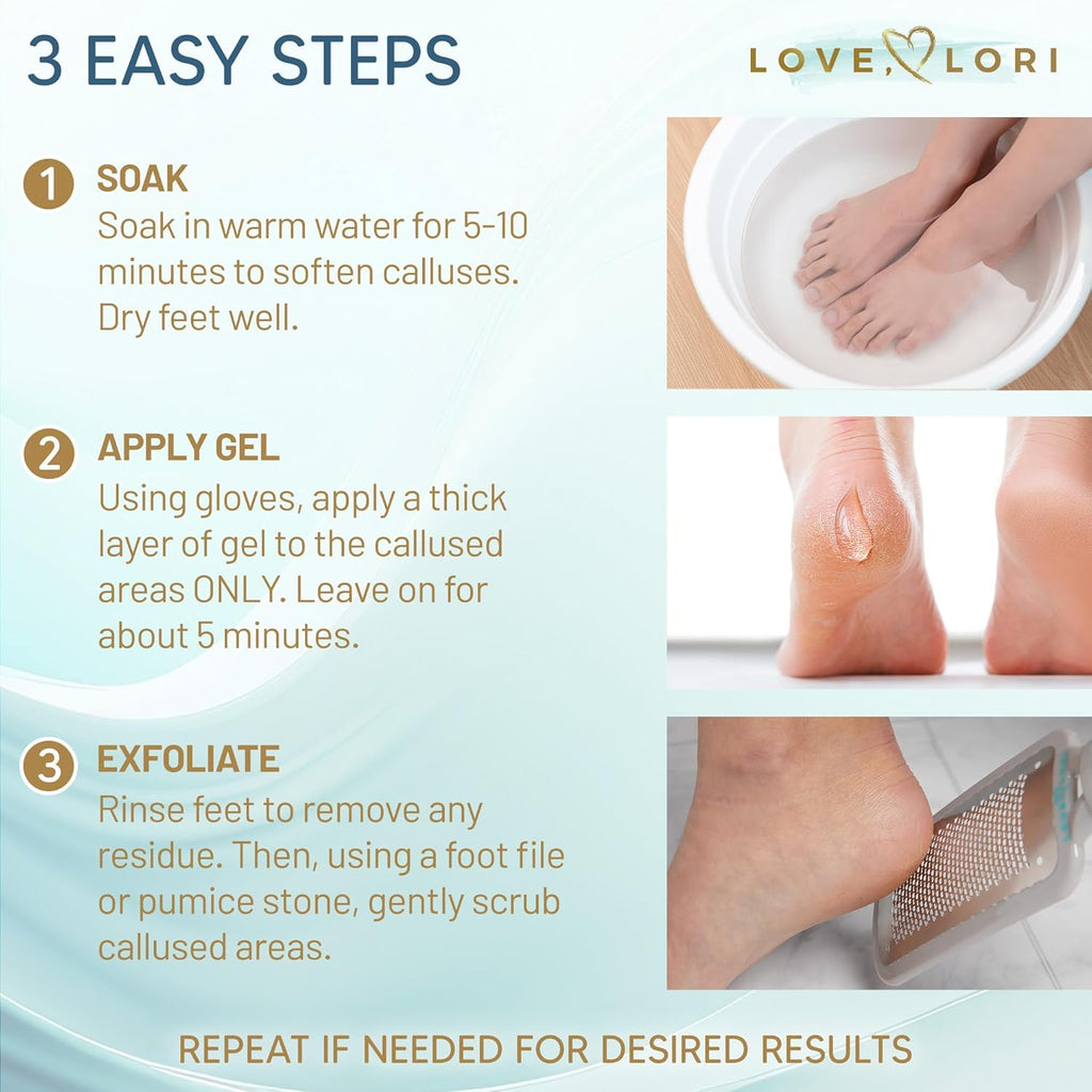 Callus Remover for Feet (Extra Strength) Foot Callus Remover Gel - Pedicure Tools for Feet Scrubber – Foot Care Spa Essentials, 6Oz