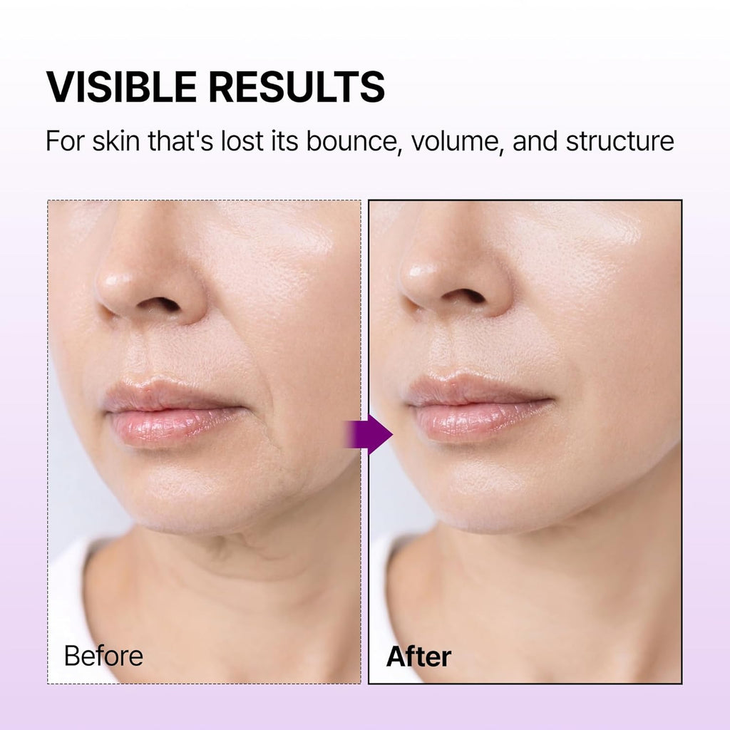 Dr.Melaxin Calcium Bonding Serum with REBORNIC 10,000Ppm, Firming & Volumizing Serum for Sagging Skin, Calcium Complex & Collagen for Elasticity & Skin Density, 1.69 Fl.Oz