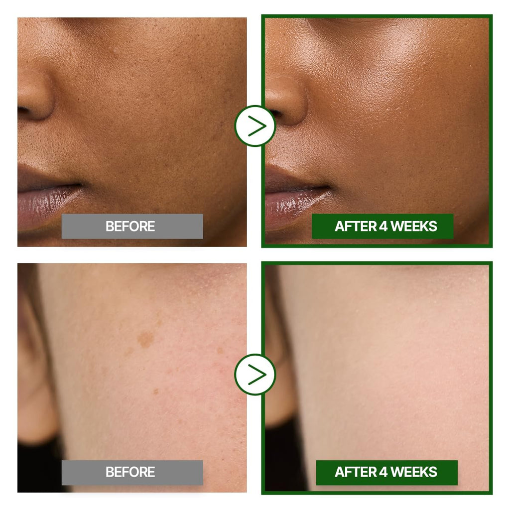 GOODAL Green Tangerine Vitamin C Cream [Advanced Ver.] – Vitamin C Cream with 5% Niacinamide | Fades Dark Spots, Boosts Radiance & Hydrates | Korean Skincare 1.69Oz / 50Ml
