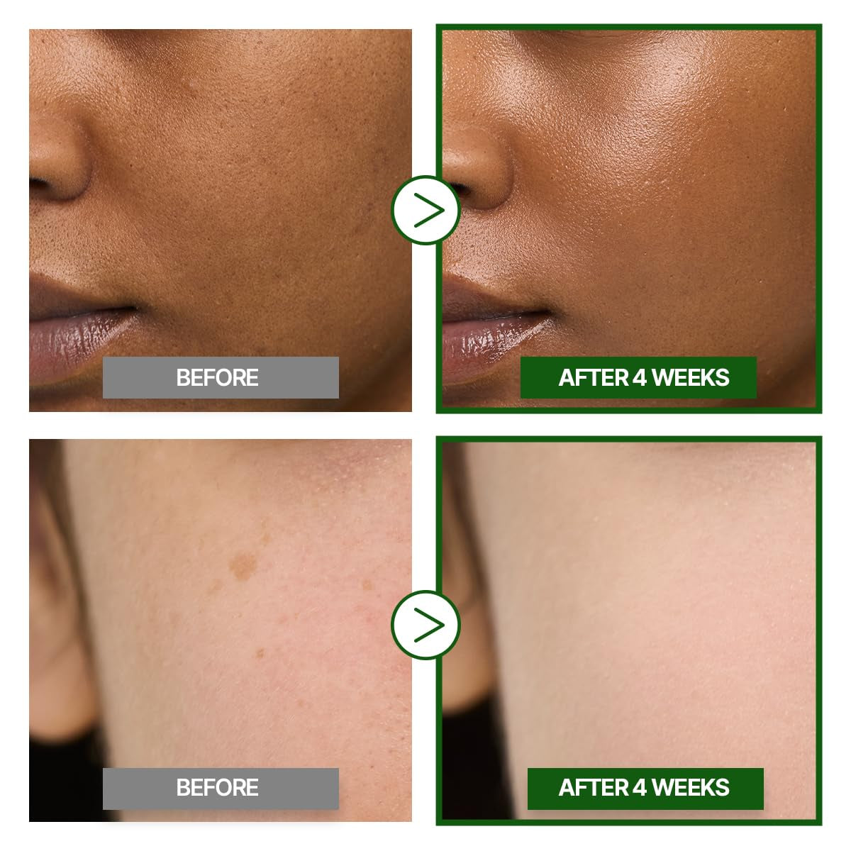 GOODAL Green Tangerine Vitamin C Cream [Advanced Ver.] – Vitamin C Cream with 5% Niacinamide | Fades Dark Spots, Boosts Radiance & Hydrates | Korean Skincare 1.69Oz / 50Ml