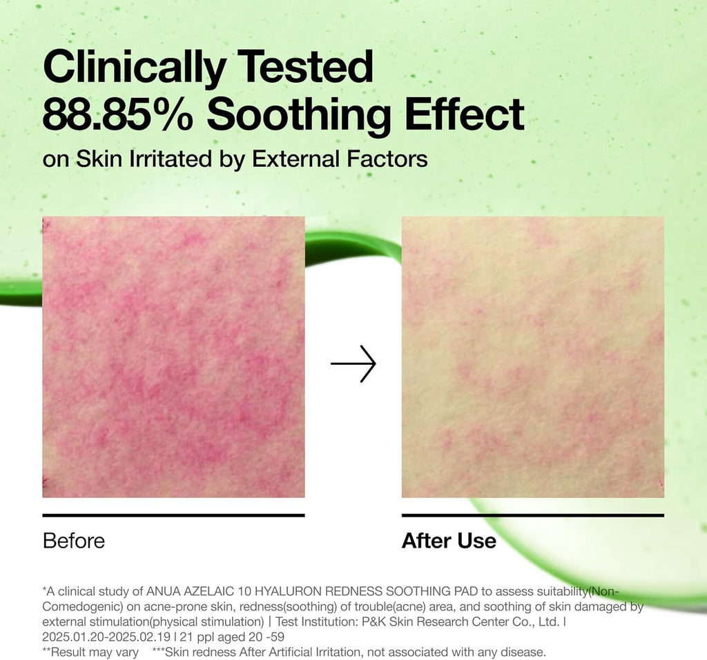 ANUA Azelaic 10 Hyaluron Redness Soothing Pad, Troubled & Spot Care, Quick & Easy Stretchable Facial Mask with Azelaic Acid, Hyaluronic Acid, Korean Skincare (90 Pads)