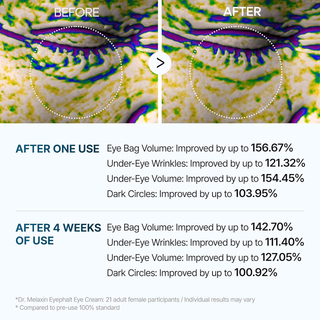 Dr.Melaxin Eyephalt Eyebag Cream 10Ml