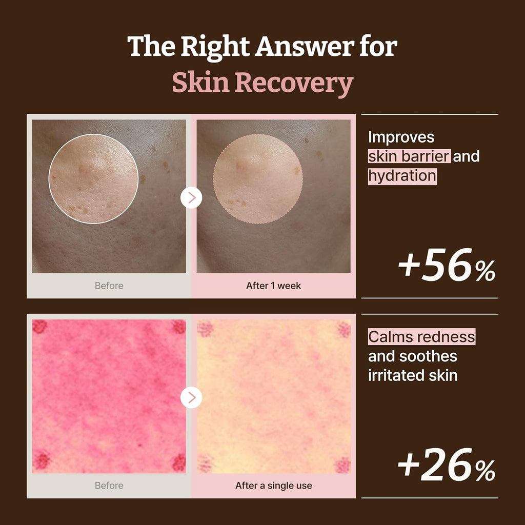 Dr. Reju-All Advanced PDRN Rejuvenating Cream Max – 99% Pure Salmon DNA Gel Type Face Moisturizer – Optimal 1200Ppm for Glass Skin & Plumping – Korean Pharmacy Anti-Aging Skin Care Face Cream -2 Fl Oz