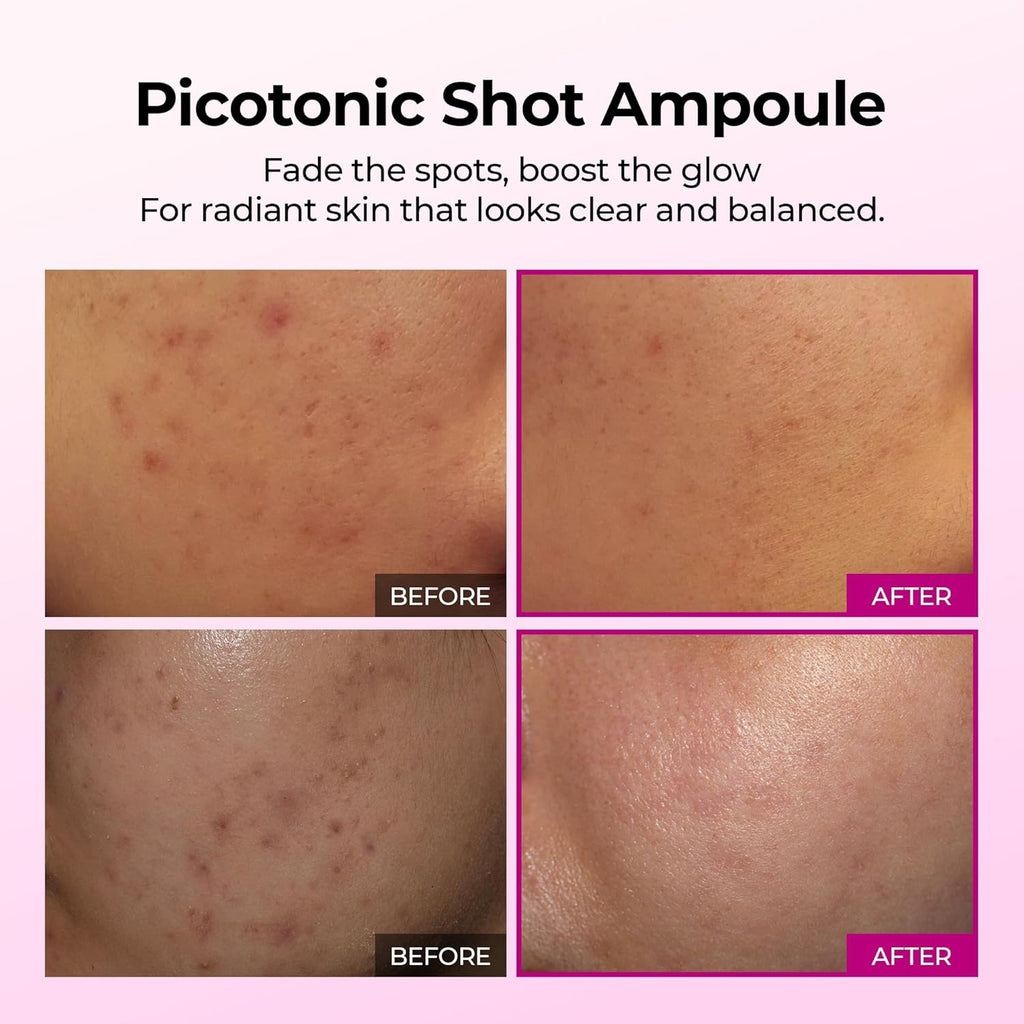 Dr.Melaxin Picotonic Shot Serum with Alpha-Arbutin & Niacinamide, Firming Density Serum for Even Skin Tone, Anti-Aging & Dark Spot Care, 1.01 Fl.Oz