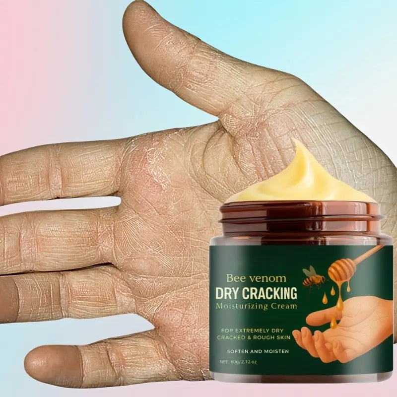 Bee Venom Moisturizing Hydrating Cream for Dry Cracked Feet and Hands, Hydrating Hand Balm, Deep Hydration Softens Light Skin, Smooth and Soft, Hand Restore Cream