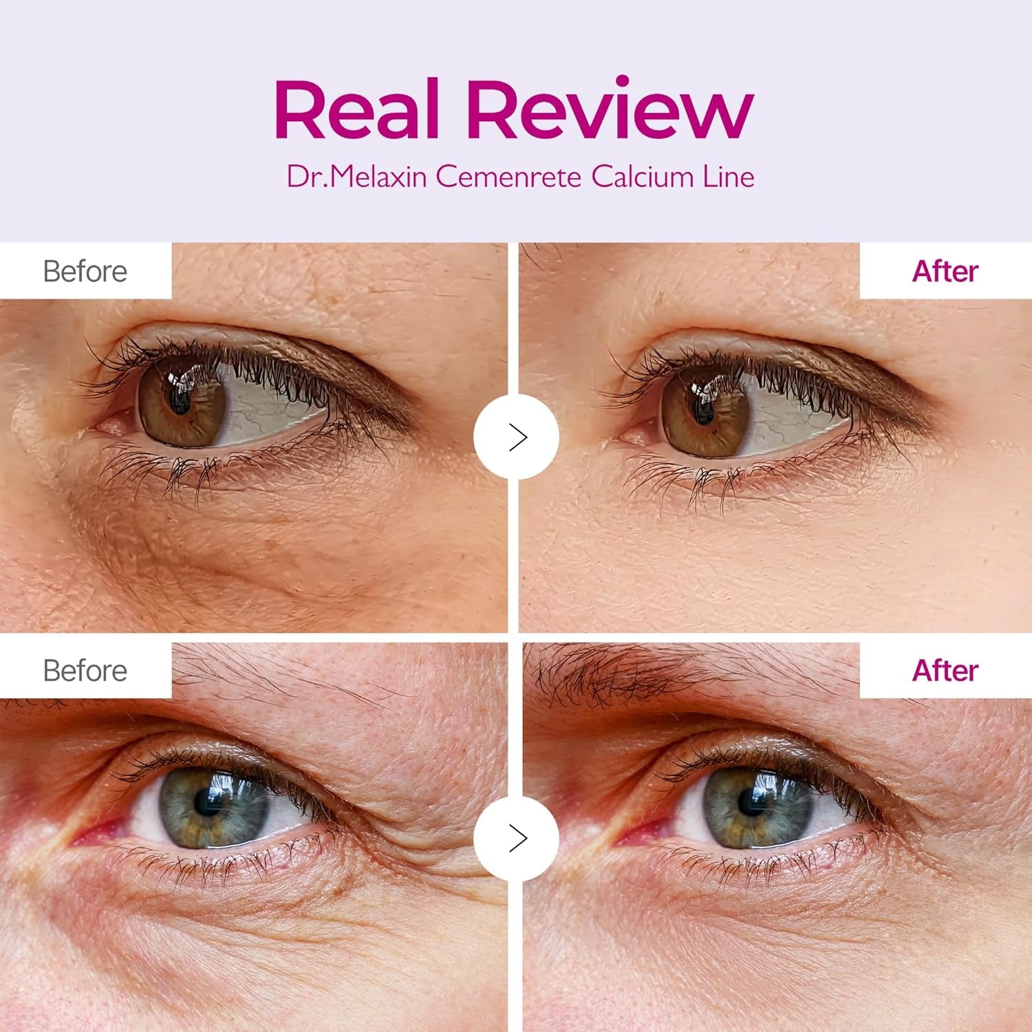 Dr.Melaxin Cemenrete Calcium Volume Eye Patch for Sagging under Eye Skin, Eye Mask Care for Wrinkles, Puffy Eyes & Dark Circles (60Patches)