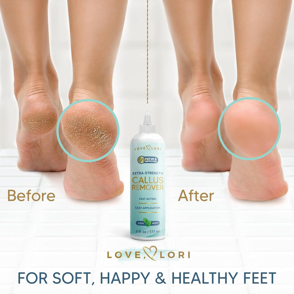 Callus Remover for Feet (Extra Strength) Foot Callus Remover Gel - Pedicure Tools for Feet Scrubber – Foot Care Spa Essentials, 6Oz