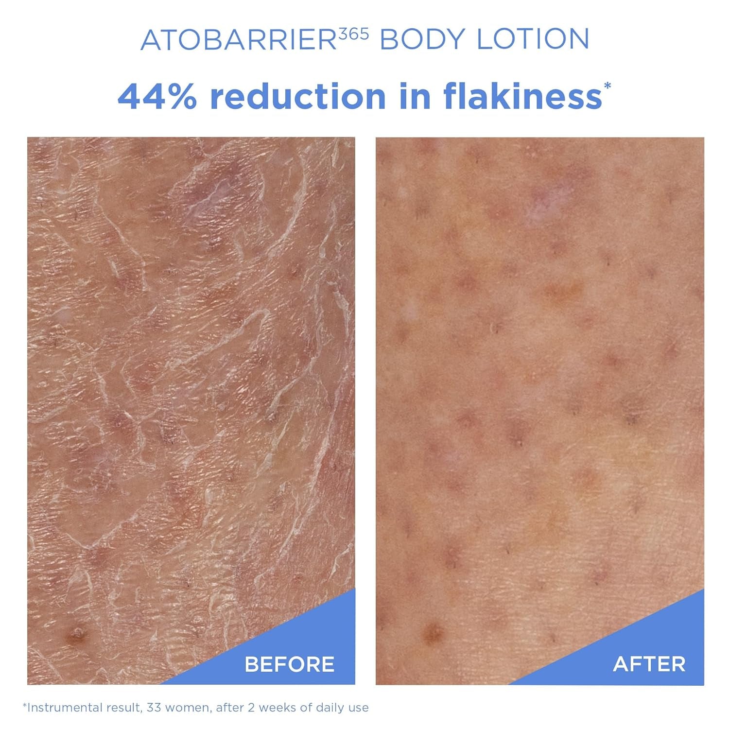 AESTURA ATOBARRIER365 Korean Body Lotion with Ceramides & Glycerin | Lightweight Hydrating Moisturizer for Dry, Sensitive & Eczema-Prone Skin | Fragrance-Free | Korean Skin Care, 400 Ml / 13.5 Fl Oz