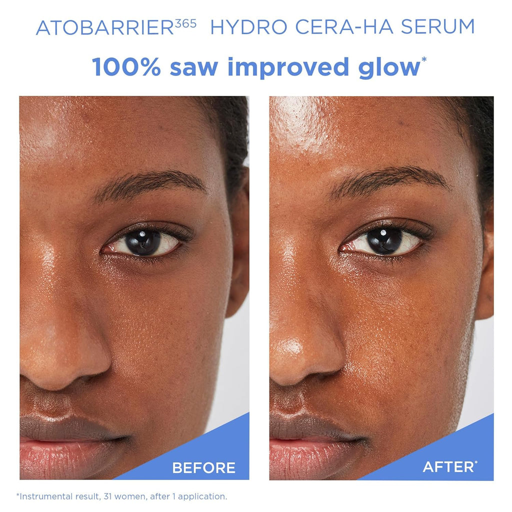 AESTURA ATOBARRIER365 Hydro CERA-HA Korean Face Serum with Ceramides, Hyaluronic Acid & Niacinamide | Lightweight Hydrating Serum for Barrier Repair & Glow for Dry & Sensitive Skin, 30ML / 1.01 Fl.Oz.