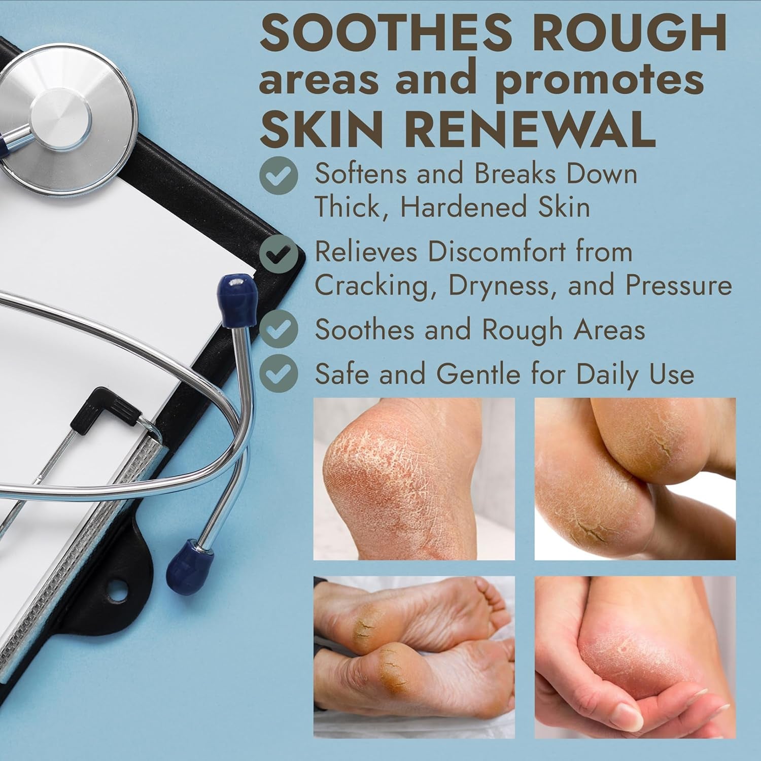 Callus Remover for Feet | Extra Strength Callus Remover Gel for Feet with Tea Tree Oil | Professional-Grade Pedicure Treatment | 50 Applications per Bottle, Includes 3 Pumice Stones | 14 Fl Oz