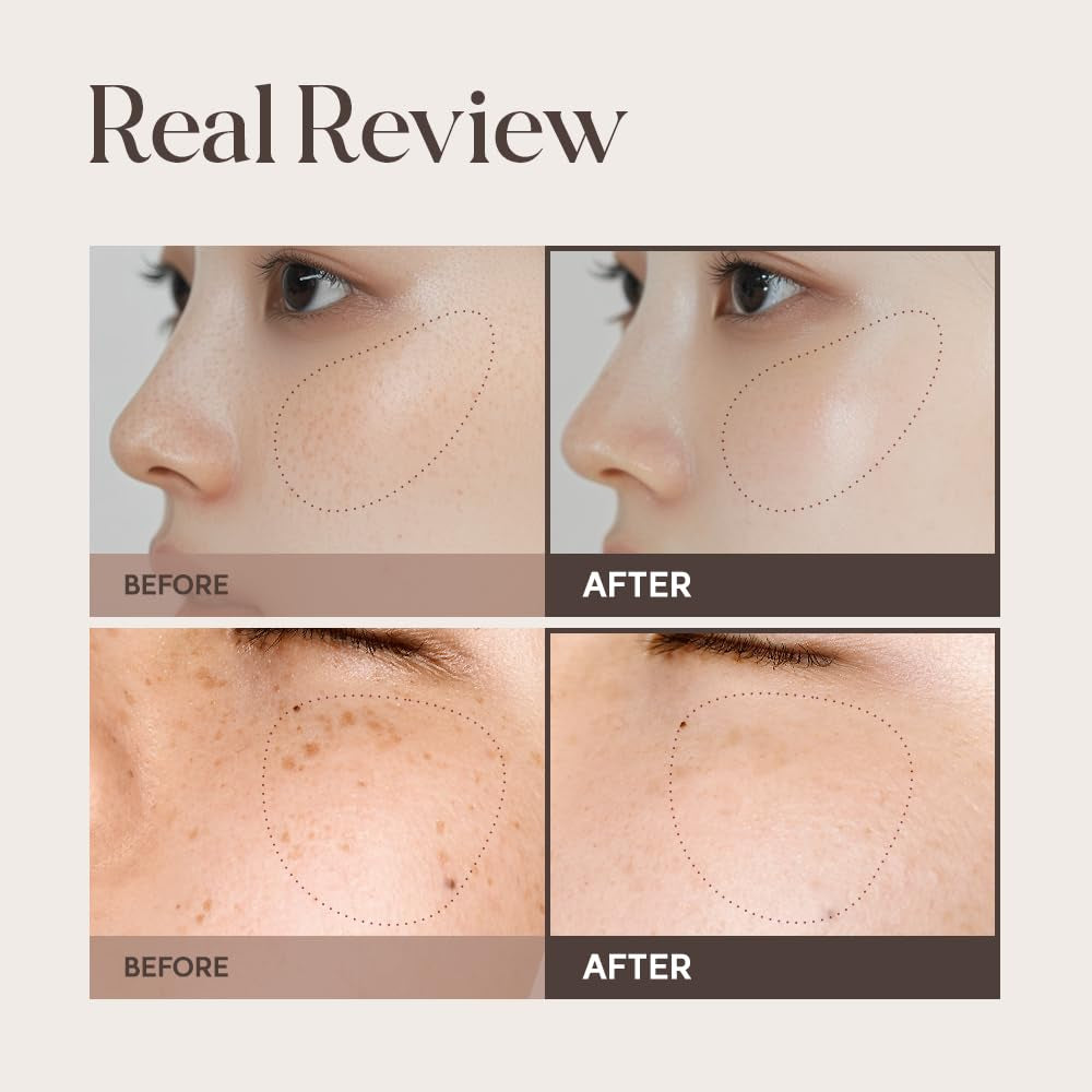 Mela Clinic Ampoule with NK Cell Technology, Skin Tone Care Serum with Tranexamic Acid, Glutathione & Bisabolol, 0.5 Fl Oz